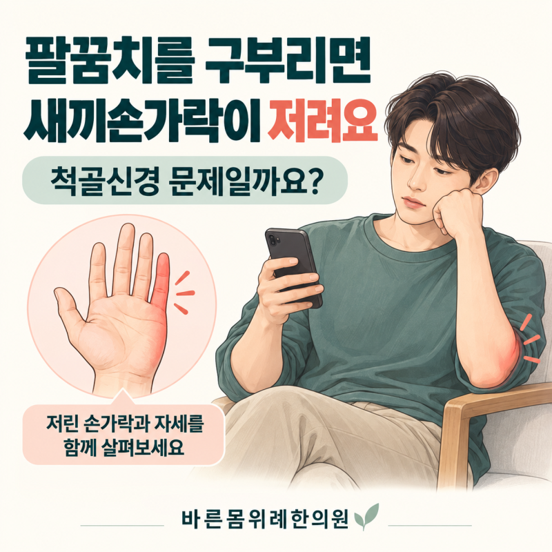 팔꿈치를 구부리면 새끼손가락이 저려요, 척골신경 문제일까요?[바른몸위례한의원]