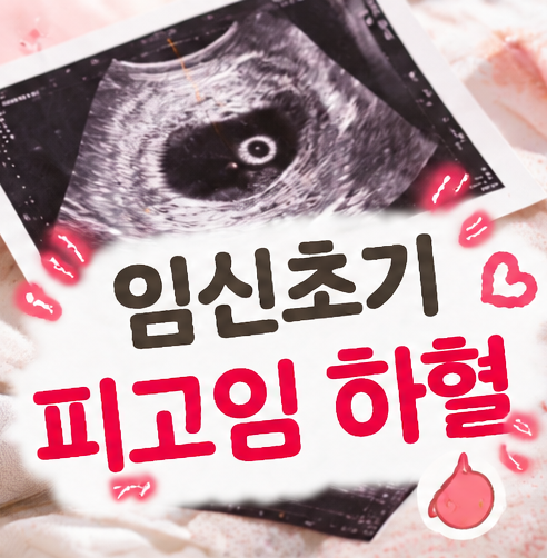임신초기 피고임 하혈 위험할 뻔 함 초음파 검사 후 입원 흡수 과정