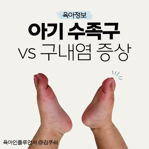 아기 수족구 증상 vs 구내염 차이부터 등원기준, 먹일 수 있는 음식 총정리