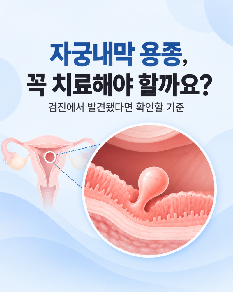 자궁내막 용종, 검진에서 발견되면 꼭 치료해야 할까요?