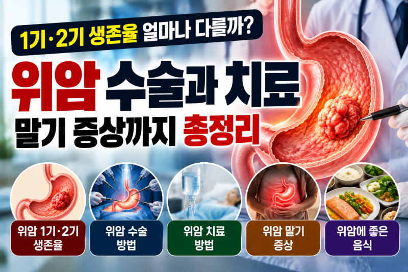 위암 1기·2기 생존율 얼마나 다를까? 위암 수술·치료방법부터 말기 증상까지 총정리