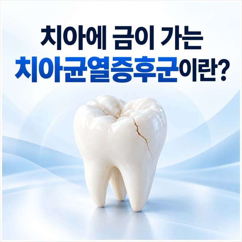 치아에 금이 가는 치아균열증후군 원인과 관리 방법 알아봐요