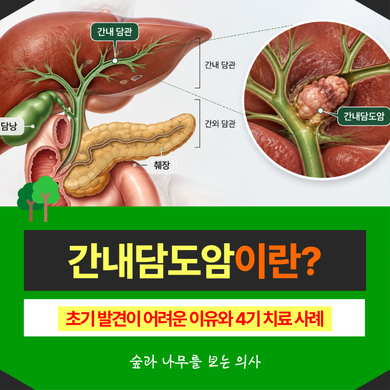 간내담도암이란? 초기 발견이 어려운 이유와 4기 치료 사례(키트루다)