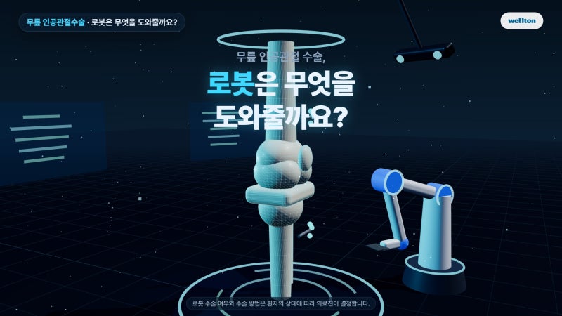 무릎 인공관절 로봇수술, 측정부터 균형 확인까지 어떤 도움을 줄까요?