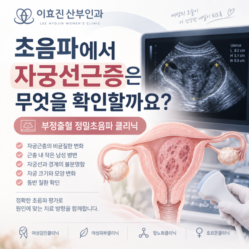 동작구 산부인과 초음파에서 자궁선근증은 무엇을 확인할까요? 부정출혈이 반복될 때 살펴....