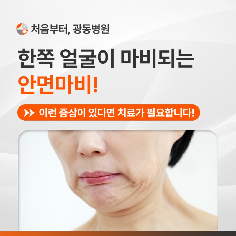 갑자기 찾아온 안면마비, 치료기간은?