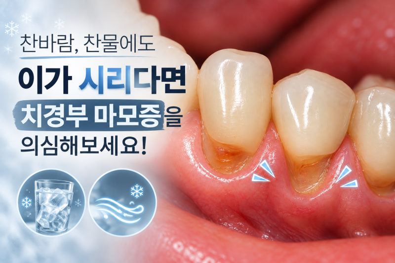 찬물, 찬 바람에도 이가 시리다면? / 치경부마모증 레진으로 간단하게 해결하기!