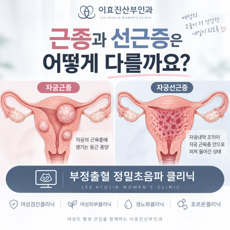 용산구 산부인과 자궁근종과 자궁선근증은 어떻게 다를까요? 부정출혈이 반복된다면 초음파....