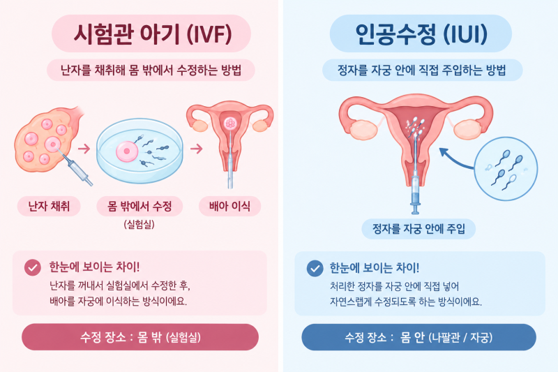 시험관과 인공수정 과정, 확률 등 비교와 시험관 선택 이유
