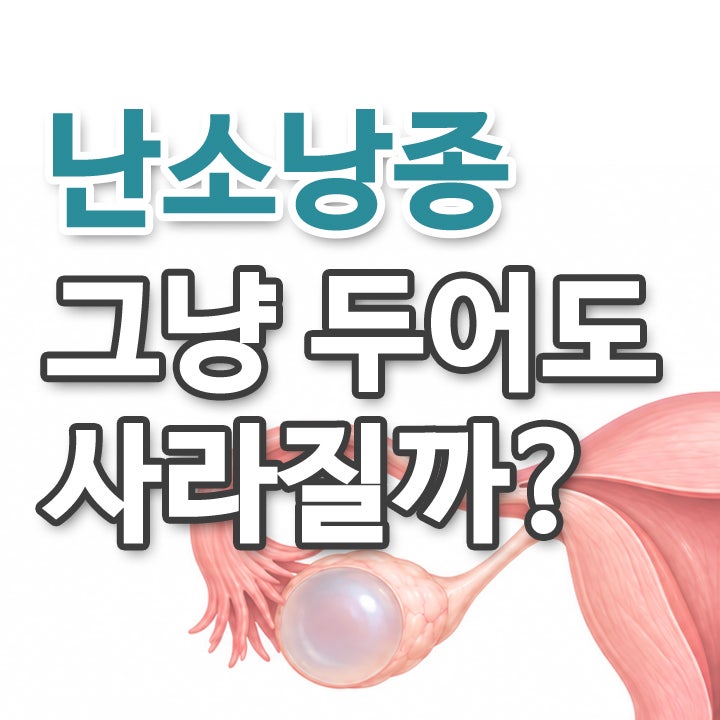 난소물혹, 저절로 없어질까? 난소낭종 종류와 치료 기준