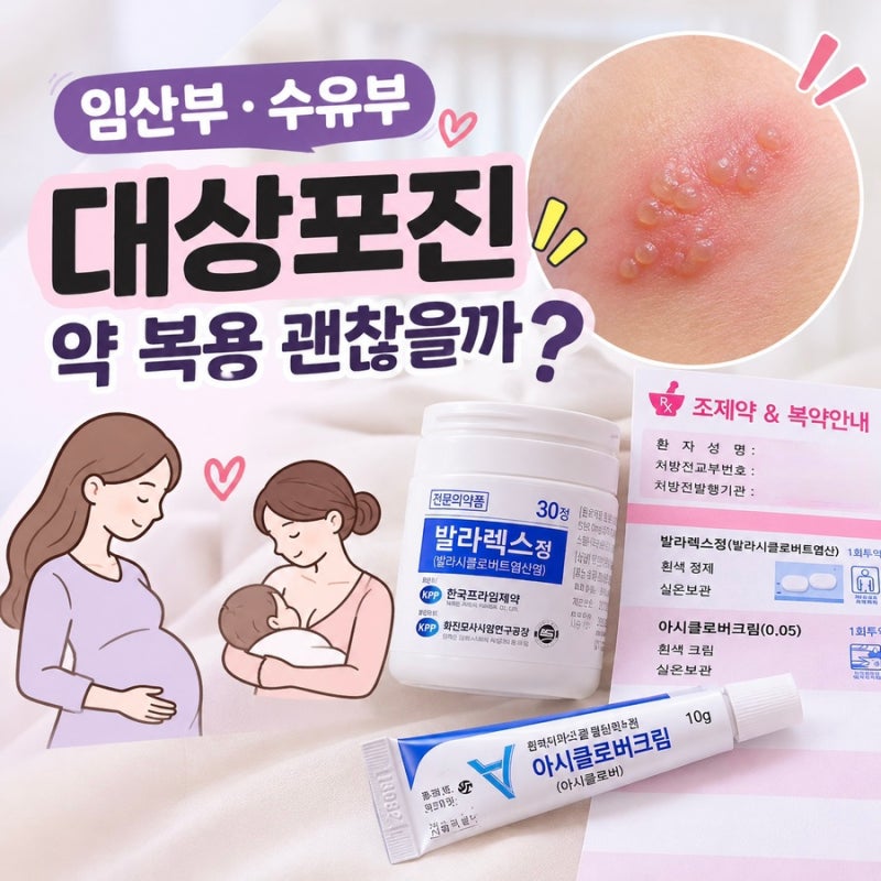 모유수유 중 대상포진 | 임산부 수유부 대상포진 증상과 처방약