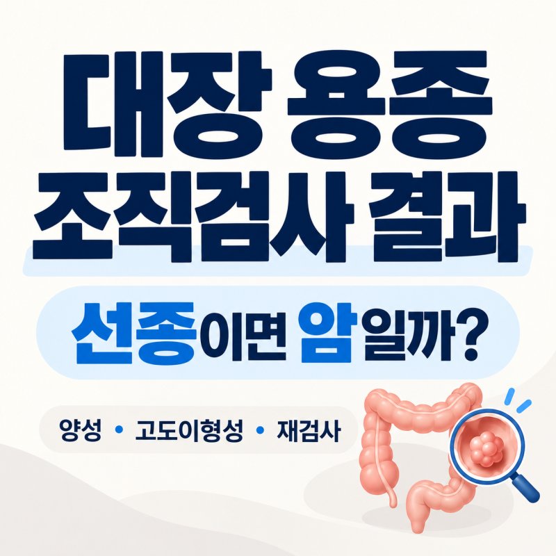 대장 용종 조직검사 결과, 선종이면 암일까? 꼭 확인할 내용