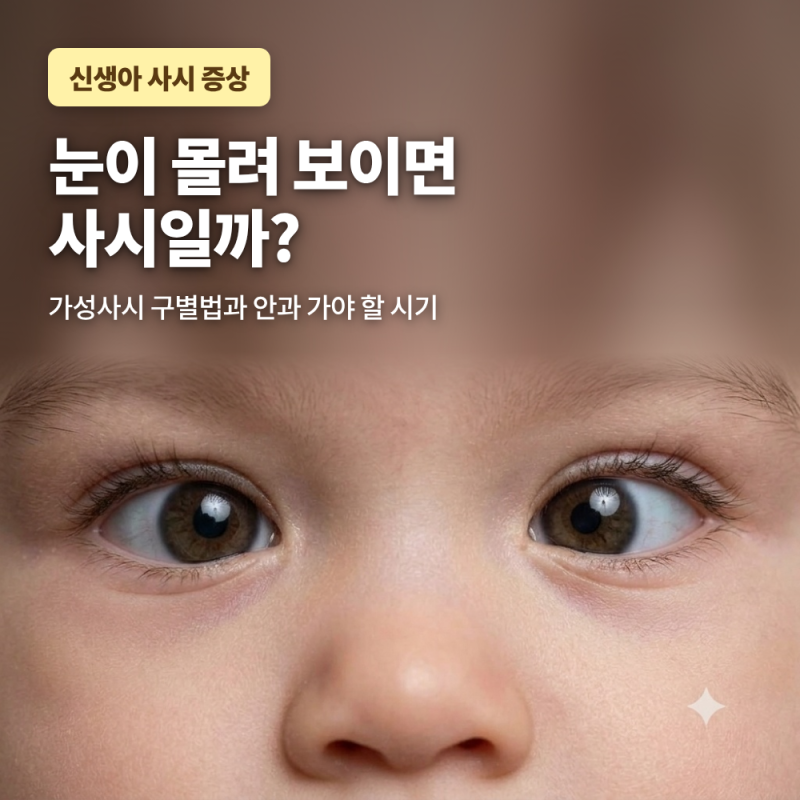 신생아 사시 증상, 눈이 몰려 보이면 사시일까? 가성사시 구별법과 안과 가야 할 시기