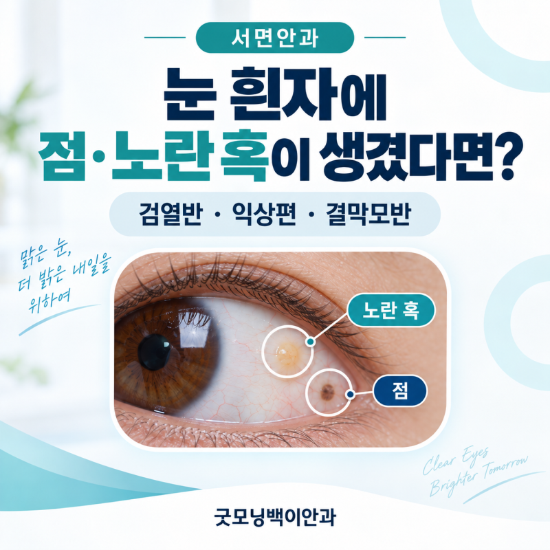 서면안과 눈 흰자에 점 · 노란 혹이 생겼다면 그냥 둬도 될까요?