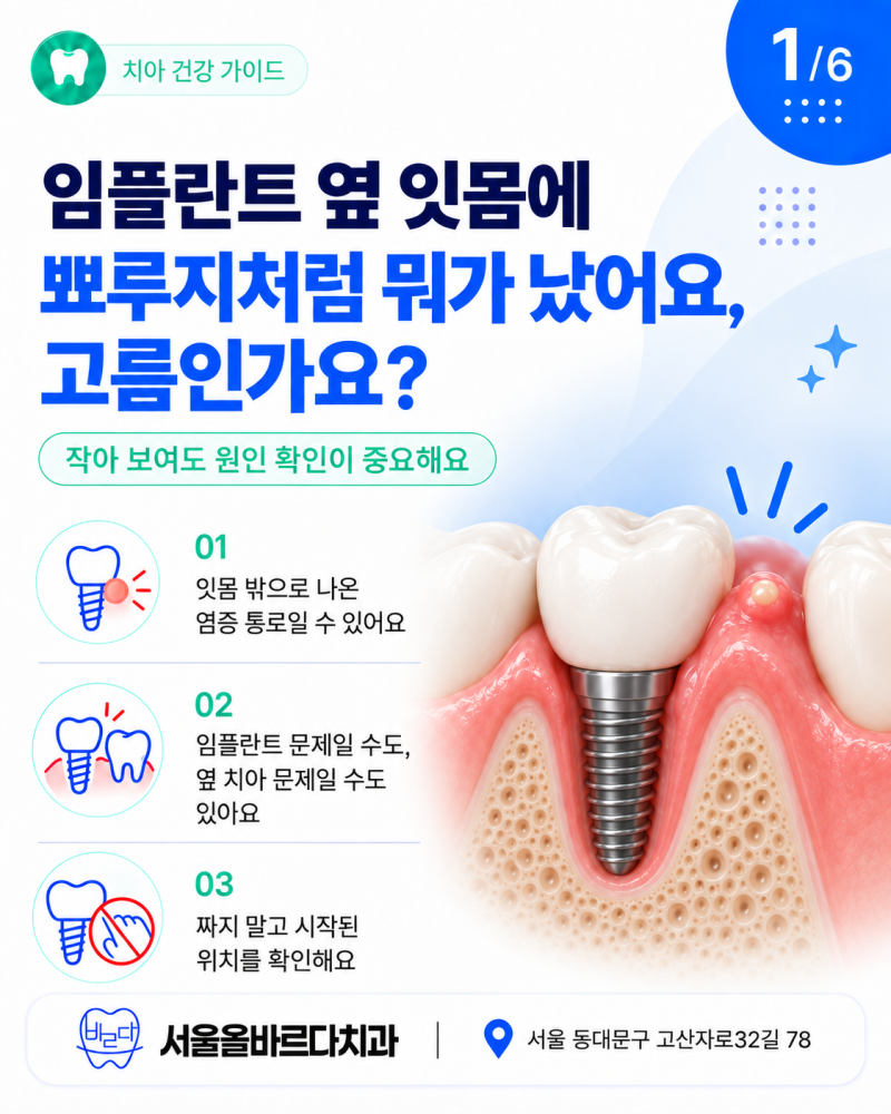 군자역치과 임플란트 옆 잇몸에 뾰루지같은게 났는데 염증 고름인가요