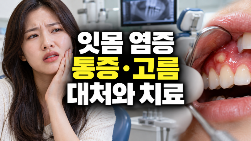 잇몸 염증 원인과 치료 방법: 통증과 고름 대처법, 치약 vs 가글 vs 치과 진료 기준