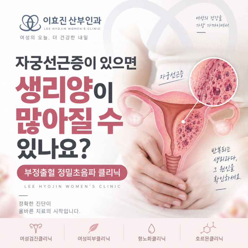 자궁선근증이 있으면 생리양이 많아질 수 있나요? 생리과다의 원인과 초음파 검사