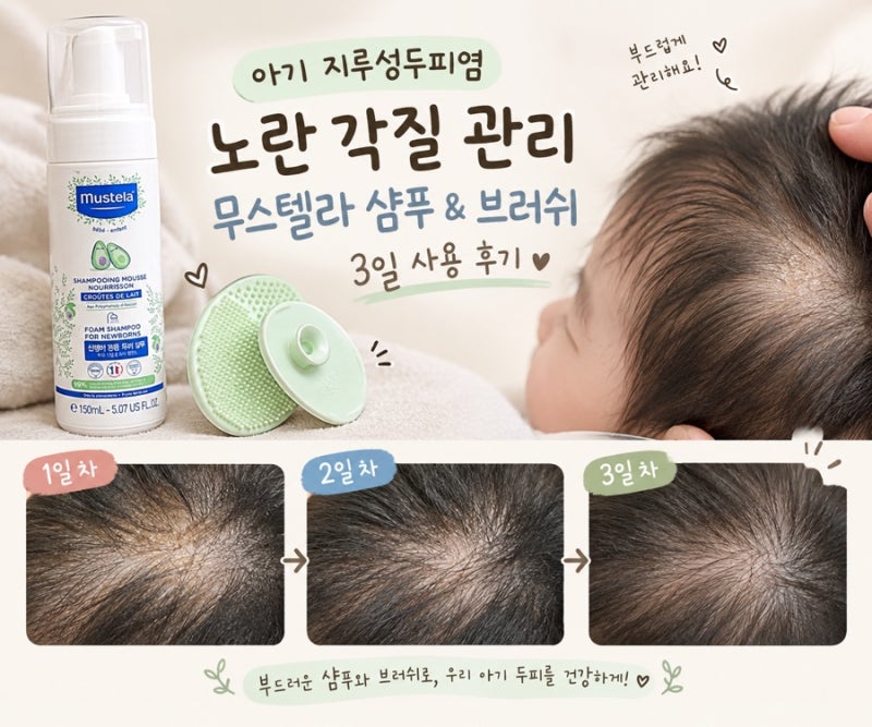 아기 지루성두피염 관리방법 (무스텔라 신생아 전용 두피 샴푸)