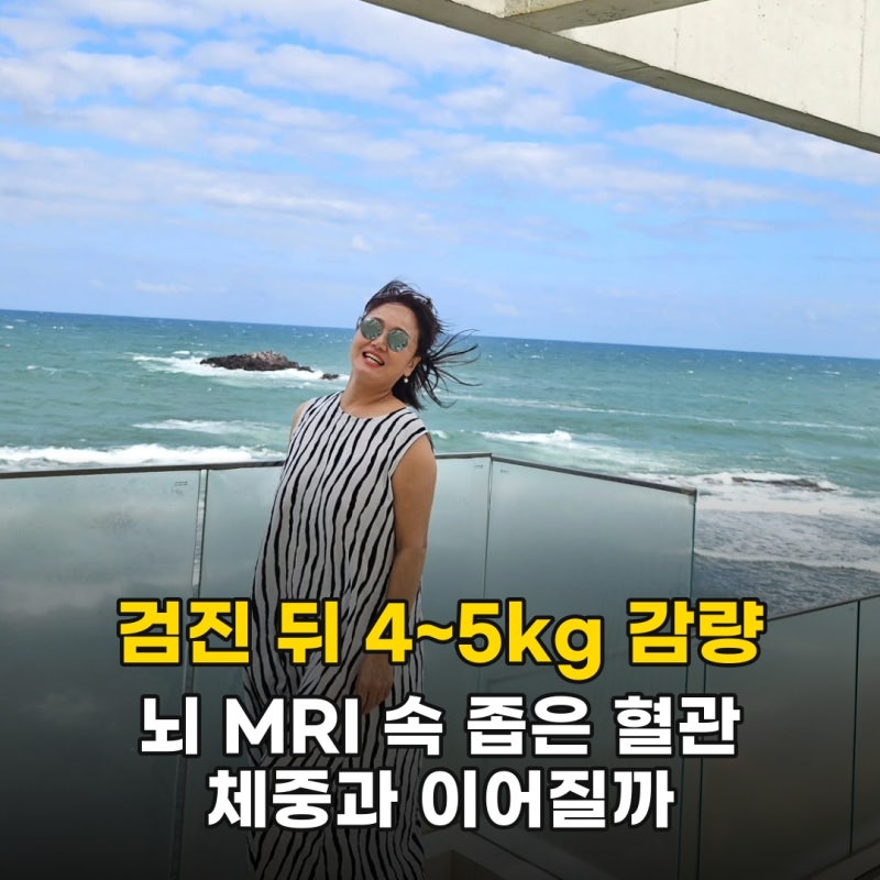 살이 찌면서 숫자가 달라졌다는 이경실, 체중과 뇌혈관은 어떻게 이어질까요?
