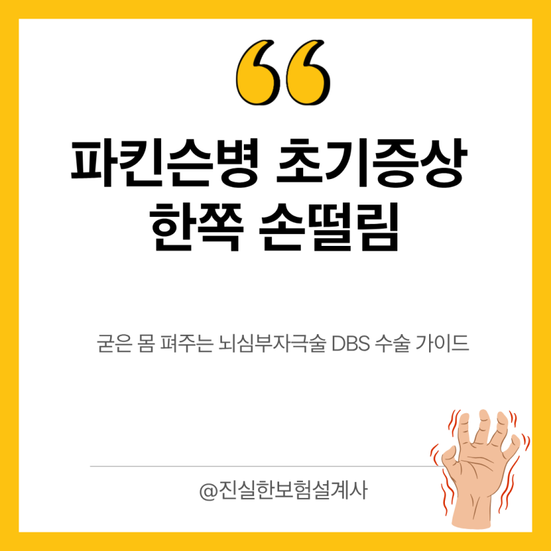 파킨슨병 초기증상 한쪽 손떨림과 굳은 몸 펴주는 뇌심부자극술 DBS 수술 가이드