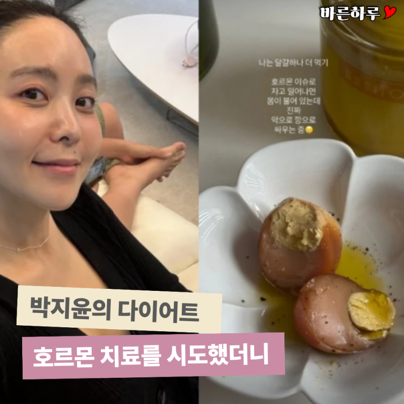 "운동하고 적게 먹어도 살찐다?" 박지윤이 고백한 자궁선근종 증상과 호르몬 치료