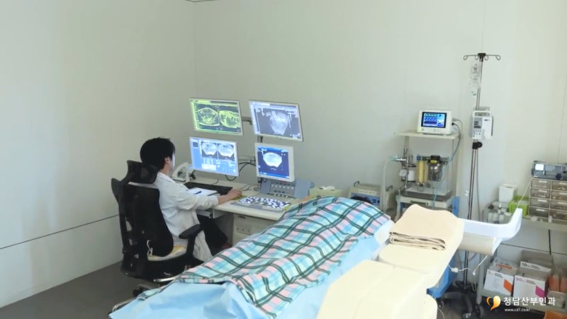난소낭종 주요 증상과 원인, 수술 기준 총정리