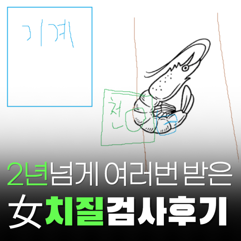 치질 검사 방법 자세 여자 항문초음파 후기