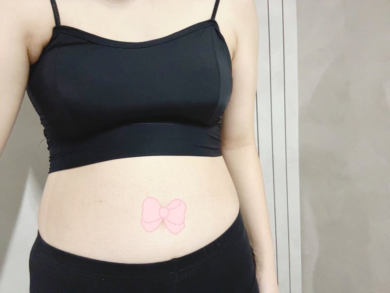 마운자로 가격 식욕억제제 효과 부작용 다이어트주사 (요요)