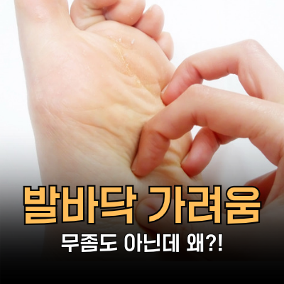 발바닥 가려움 원인, 무좀 아니어도 생길 수 있을까?