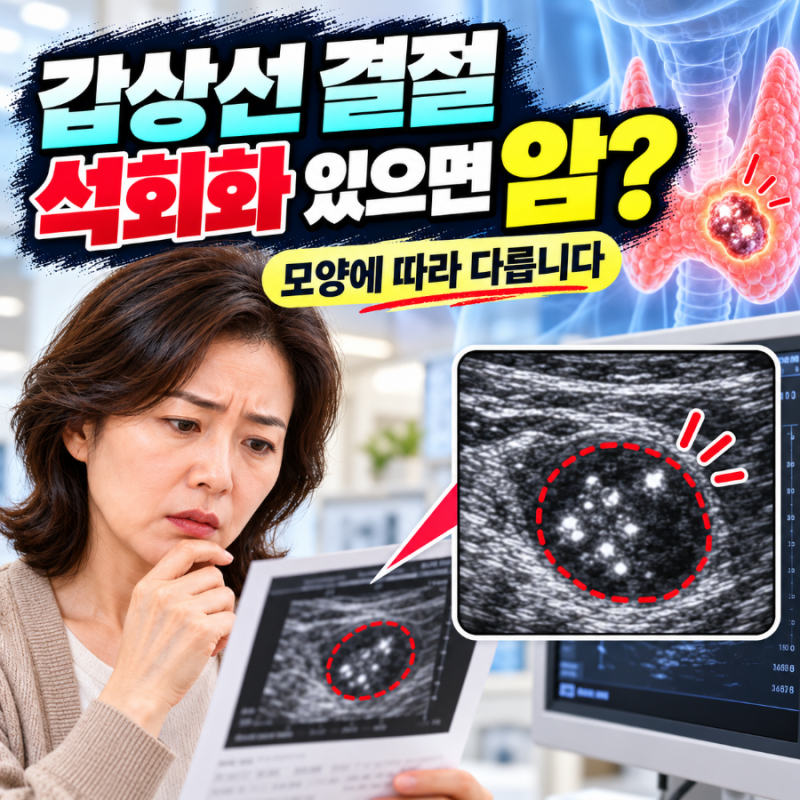 갑상선 결절 석회화, 암일까? 미세석회화와 거친 석회화의 차이
