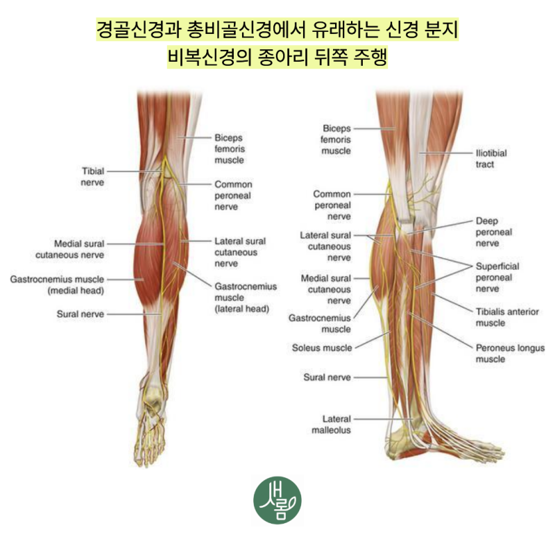 세종 종아리 근육 통증 비복근 파열, 걷기 힘들고 찢어지는 느낌이 든다면 치료는 어떻게 해....