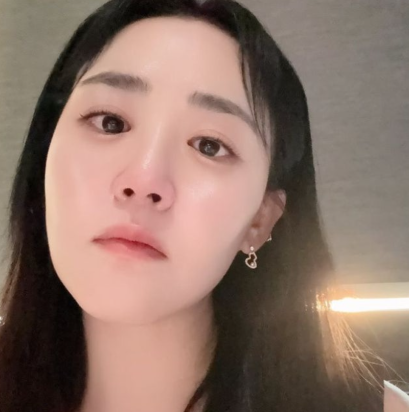 문근영, 정평이 반한 미모…4번 수술과 18년 다이어트 고백 뒤 달라진 지금