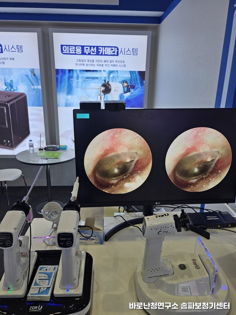 청각장애보청기 정부지원금 받으려면 먼저 확인해야 할 기본 자격