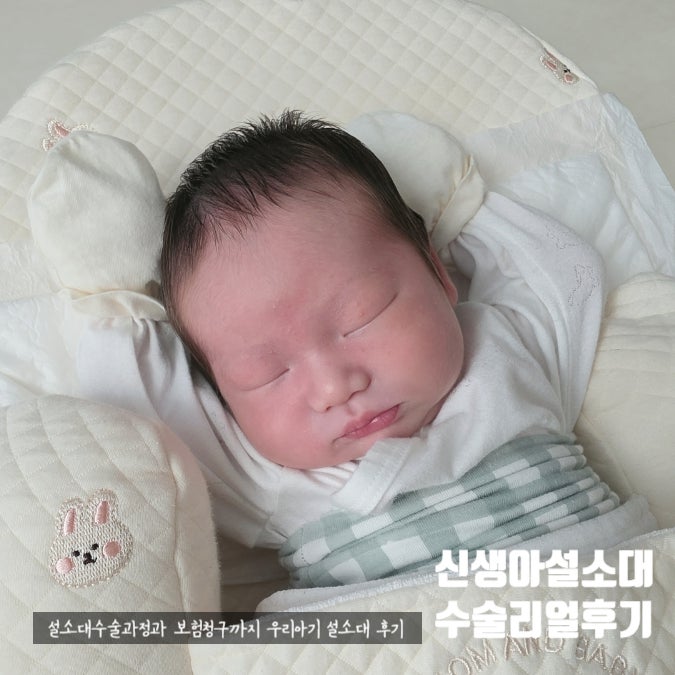 신생아 설소대 단축증 설소대 수술 직접 받아본 솔직 후기