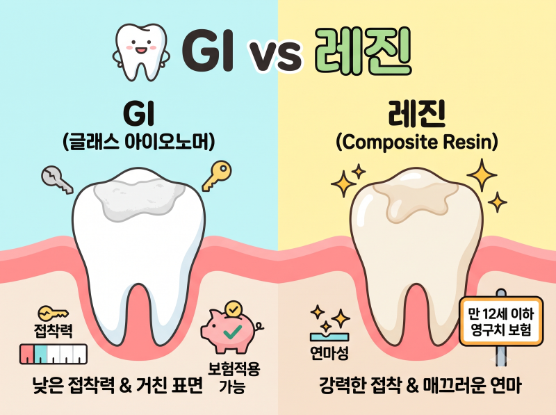 치과 충치 치료 재료 비교: GI(글래스 아이오노머) vs 레진 장단점 총정리