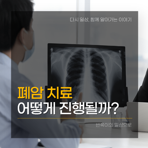 [폐암]폐암 치료 방법 총정리｜수술부터 항암치료와 방사선치료까지