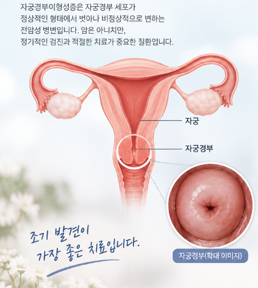 자궁경부이형성증 보험금 보상검토