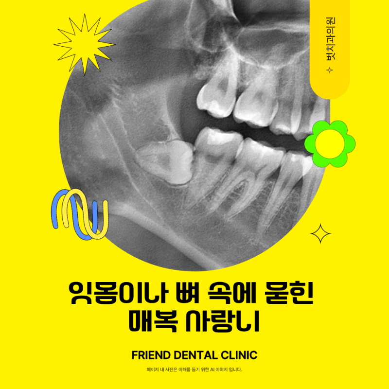 사랑니 발치 비용 얼마일까? 건강보험 적용부터 실비 청구까지 총정리