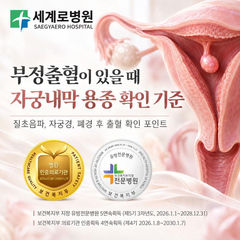 부정출혈이 있을 때 자궁내막 용종 확인 기준