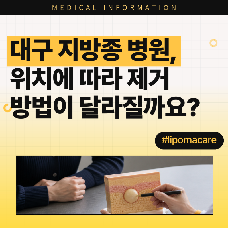 대구 지방종 병원, 위치에 따라 제거 방법이 달라질까요?