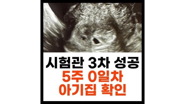 시험관 아기 3차 만에 쌍둥이 성공