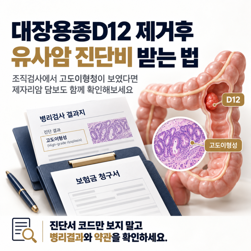 건강검진 대장용종D12 제거후 유사암 진단비 받는법 - 수원손해사정