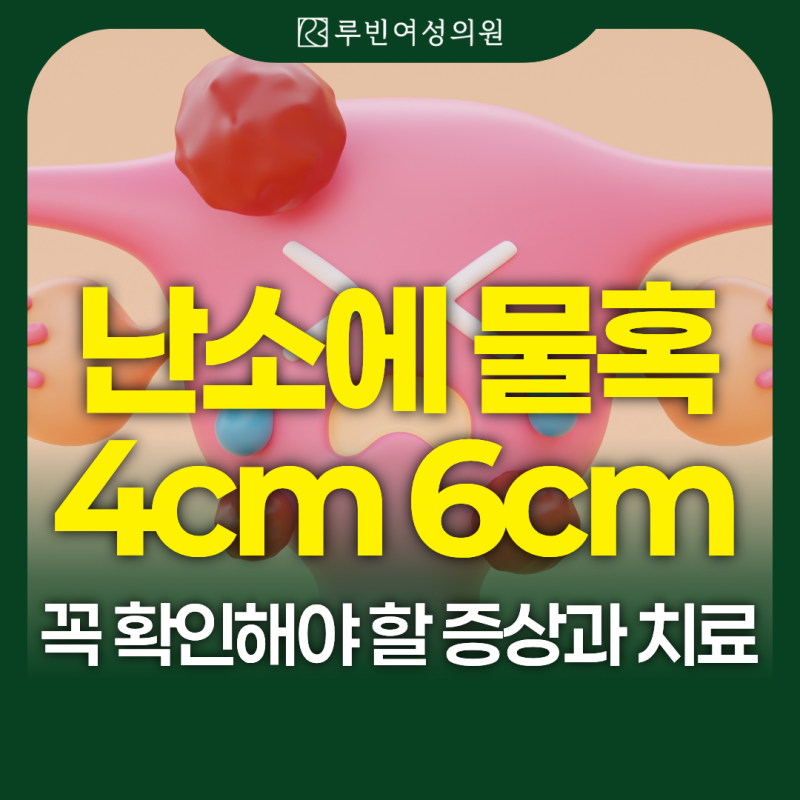 난소에 물혹 4cm 6cm 커지면 꼭 확인해야 할 증상과 치료 상도역산부인과