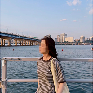 지방흡입팔뚝 전 꼭 알아야 할 5가지, 회복 기간은?