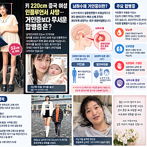키 220cm 중국 여성 인플루언서 사망…거인증보다 무서운 합병증은?