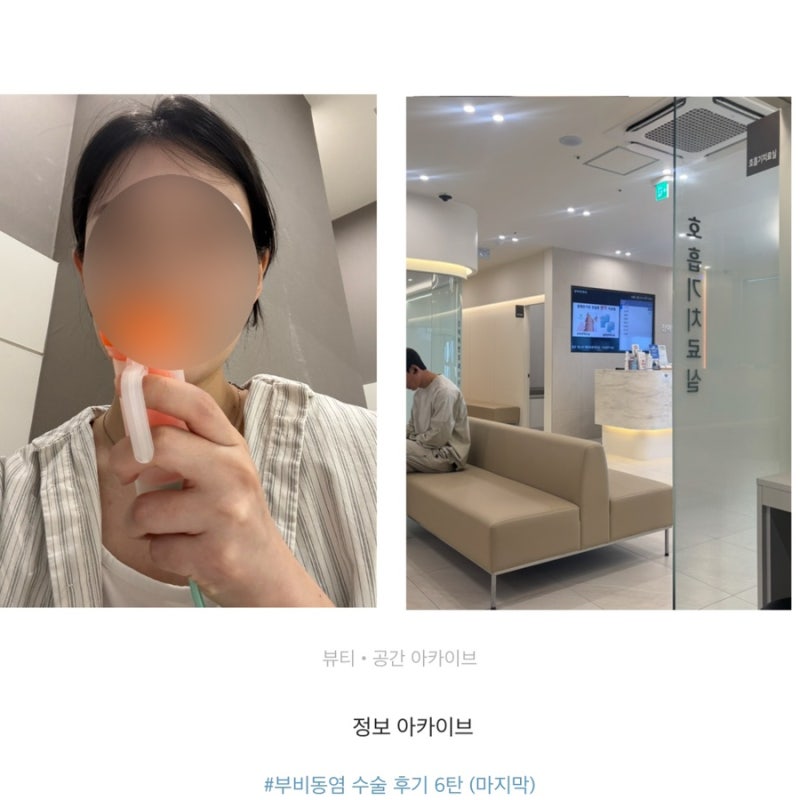 부비동염 수술 12일차 드디어 약 끊었다 코세척으로 마무리한 회복 일기 6탄