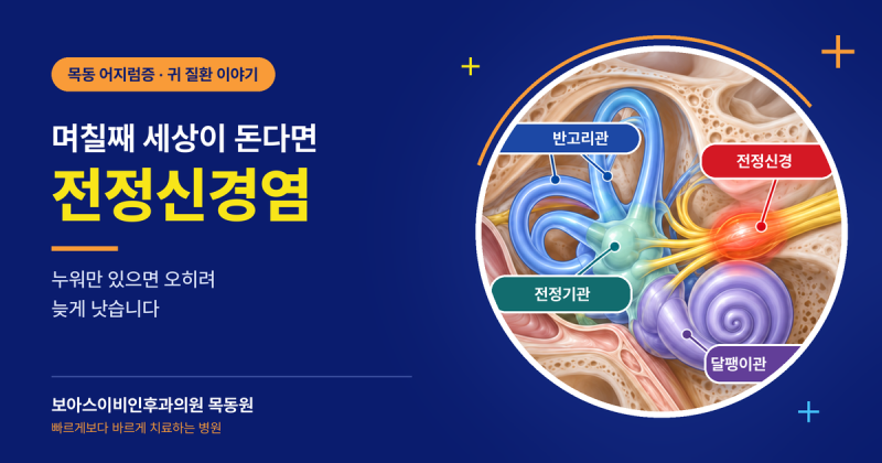 전정신경염 (Vestibular Neuritis)