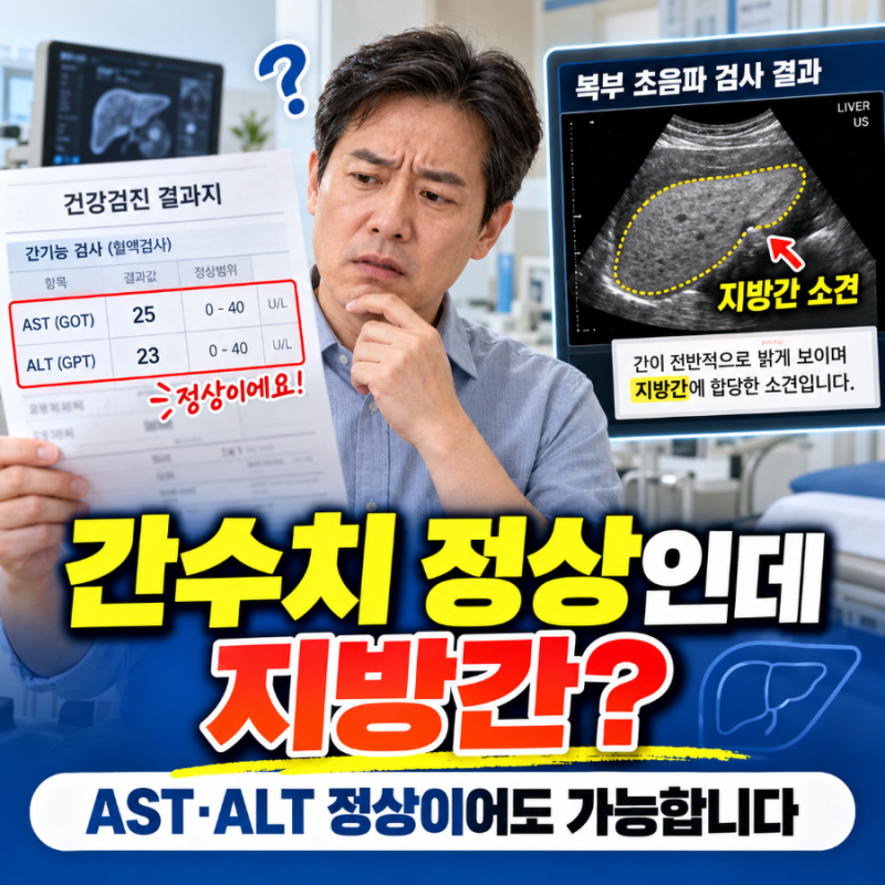 간수치 정상인데 지방간? 증상 없어도 초음파에서 발견되는 이유