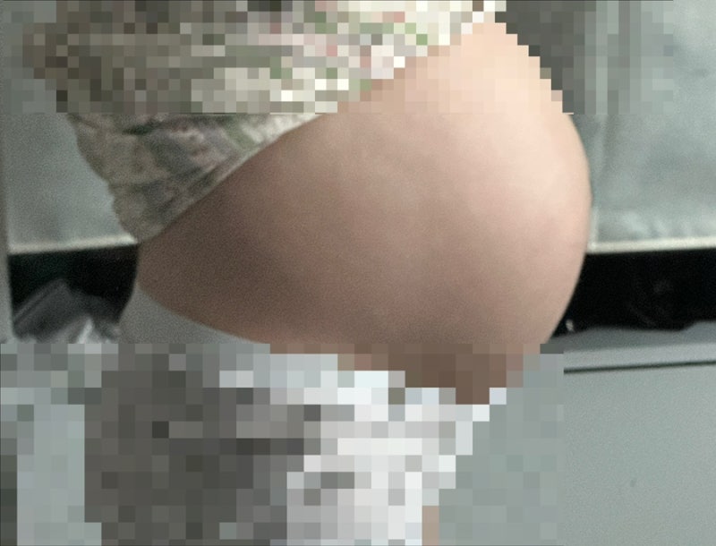 서울아산병원 응급제왕절개 후기(1)｜새벽 분만장 가는 법, 하위태반 진단부터 출산까지