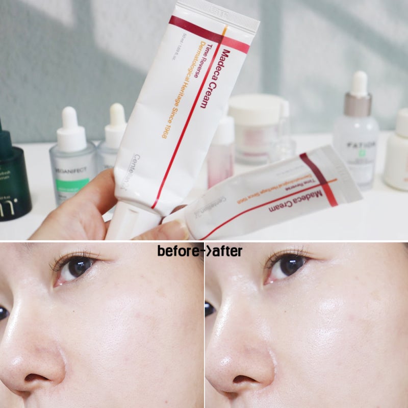 예민 피부 진정시킬 때 올리브영 추천템, 동국제약 마데카크림 내돈내산 후기+이런 분은 비....